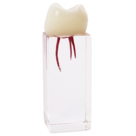 MOLAR ENDO C/CONDUCTOS PARA PRACTICAS EXTRACURRICULARES