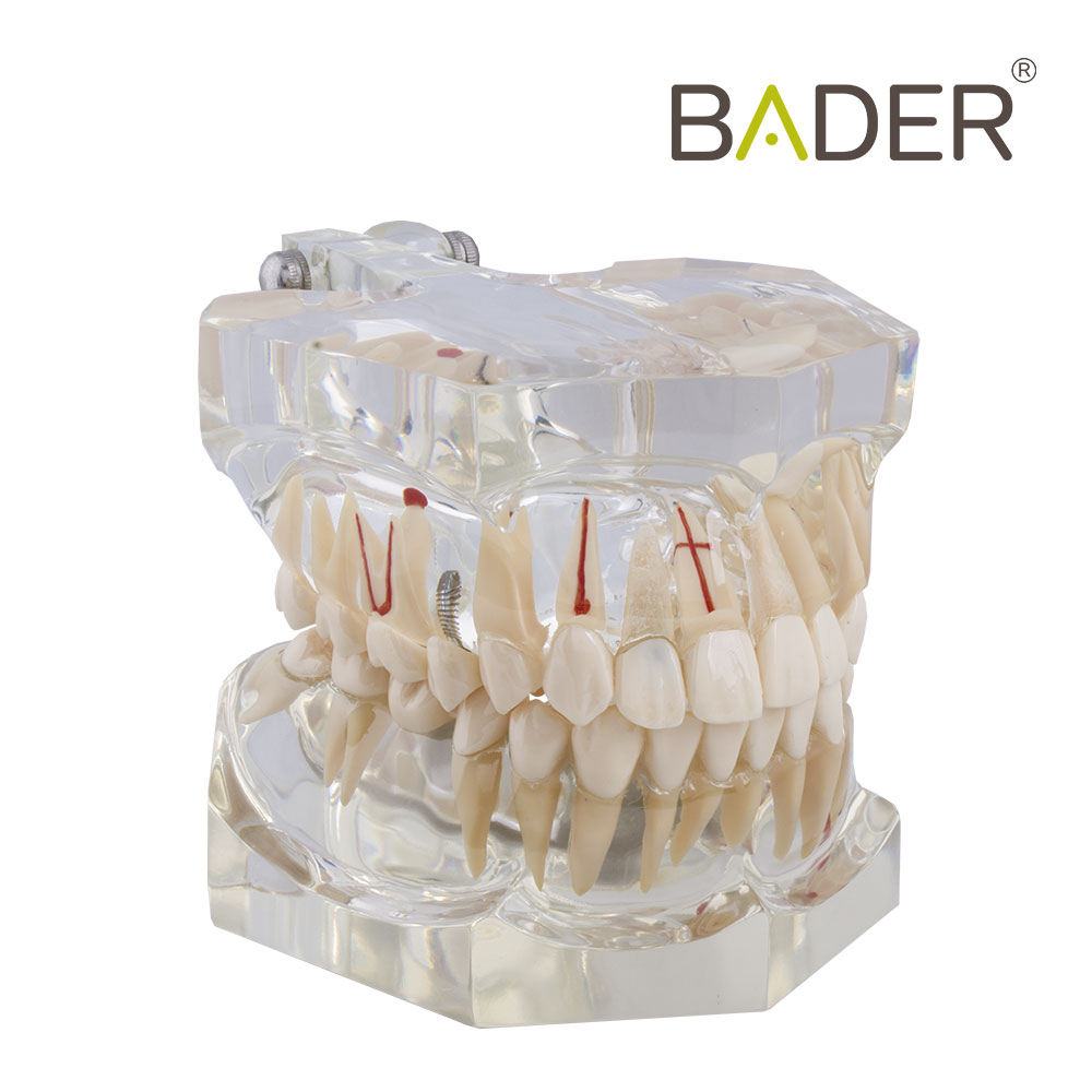 MACROMODELO CON PATOLOGÍA COMPLETA