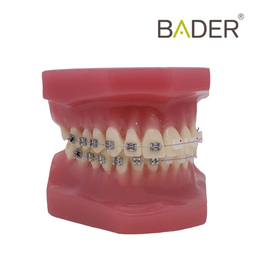 [0905102] MODELO BE BRACKET