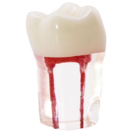 [0905104] MOLAR CON CONDUCTOS RADICULARES