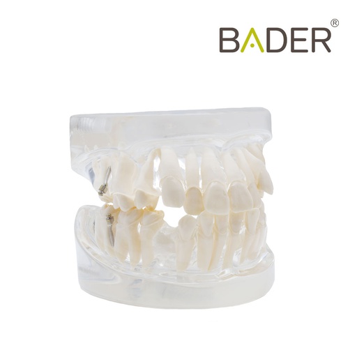 [0905116] MODELO DENTAL PARA PRÁCTICA DE ORTODONCIA